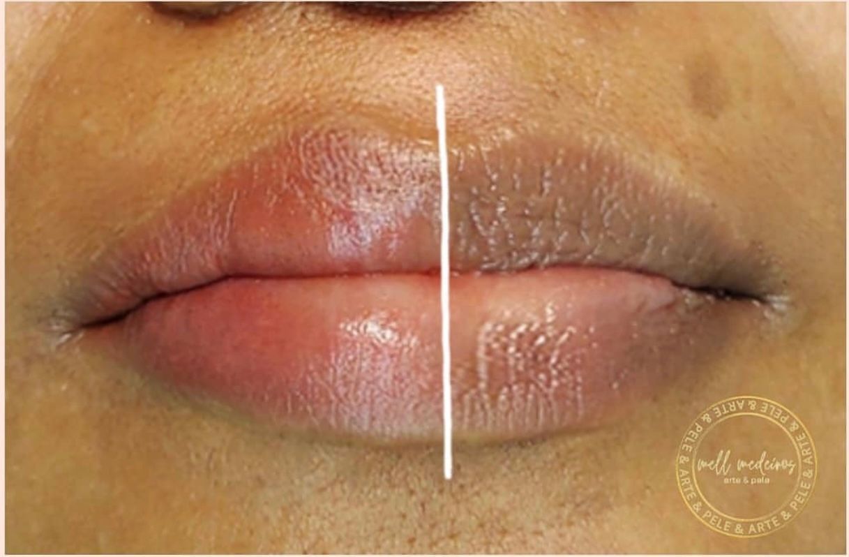 Micropigmentation des Lèvres (Lip Blush) - Melissa Medeiros - Mell Medeiros