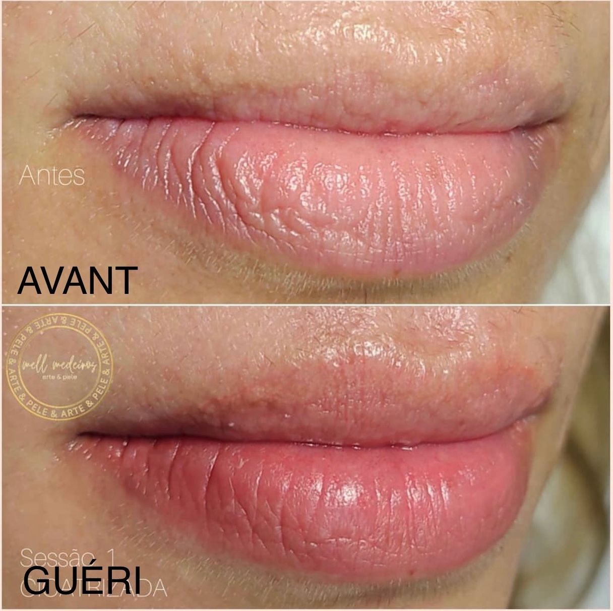 Micropigmentation des Lèvres (Lip Blush) - Melissa Medeiros - Mell Medeiros