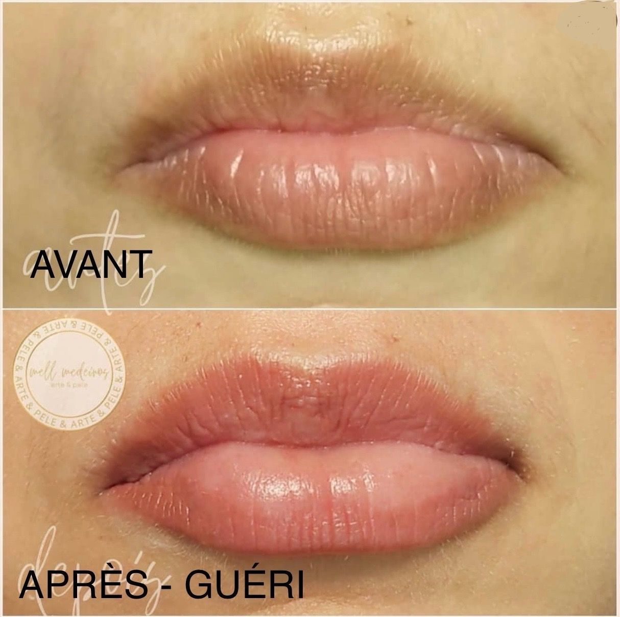 Micropigmentation des Lèvres (Lip Blush) - Melissa Medeiros - Mell Medeiros