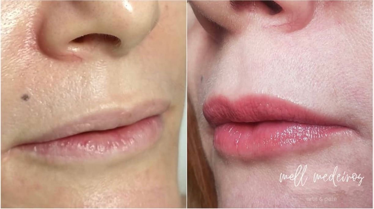 Micropigmentation des Lèvres (Lip Blush) - Melissa Medeiros - Mell Medeiros