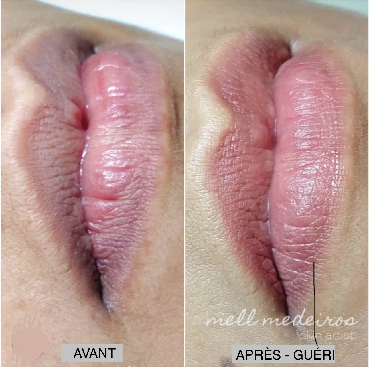 Micropigmentation des Lèvres (Lip Blush) - Melissa Medeiros - Mell Medeiros