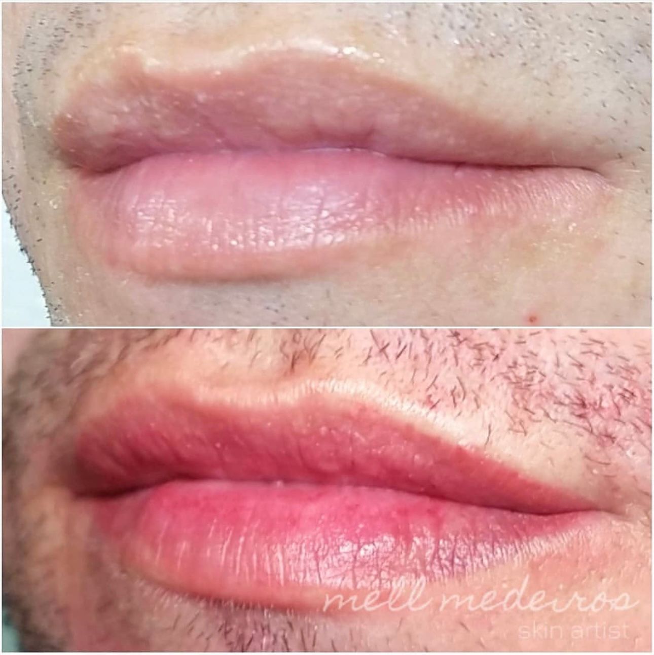 Micropigmentation des Lèvres (Lip Blush) - Melissa Medeiros - Mell Medeiros