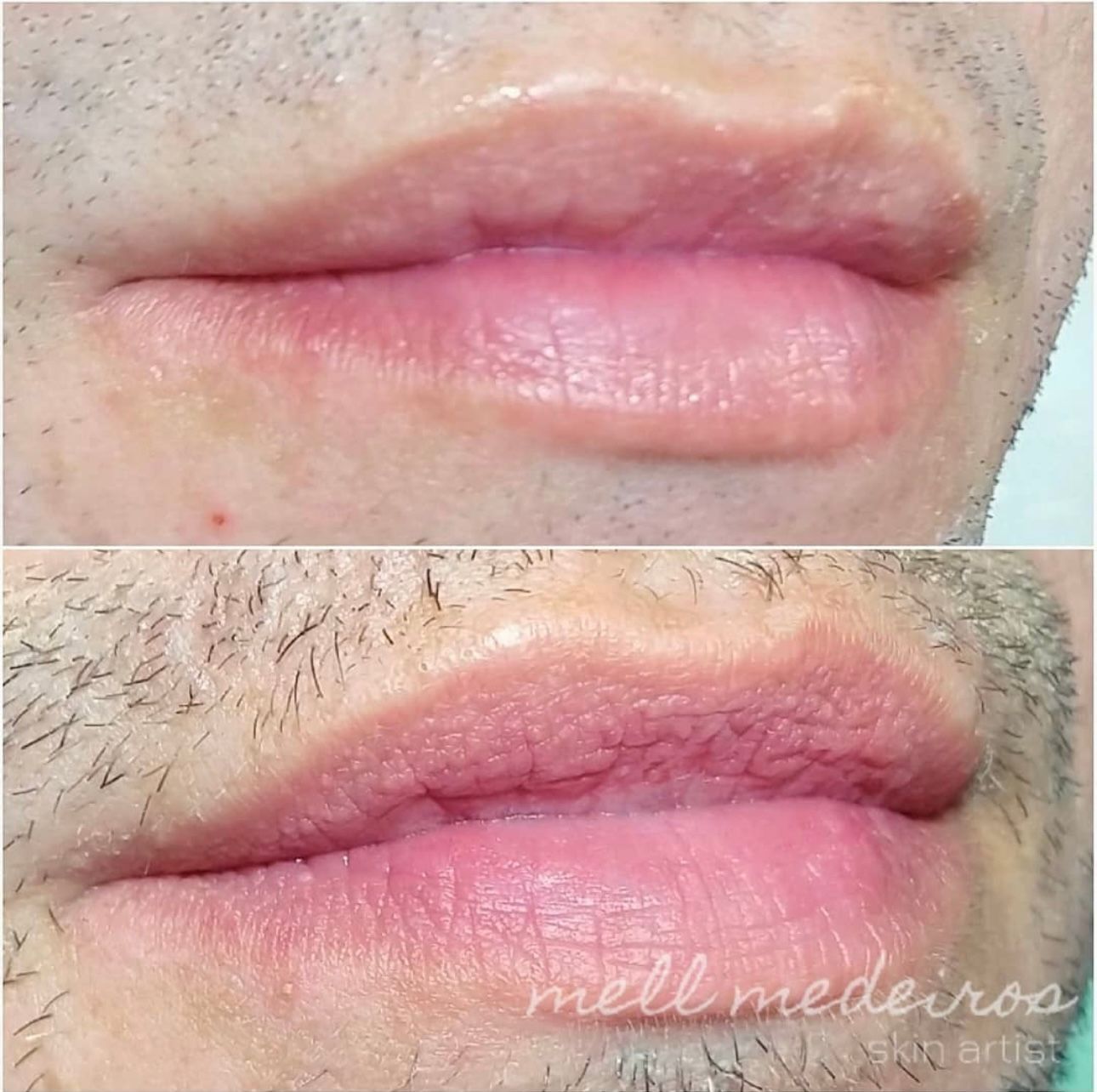 Micropigmentation des Lèvres (Lip Blush) - Melissa Medeiros - Mell Medeiros