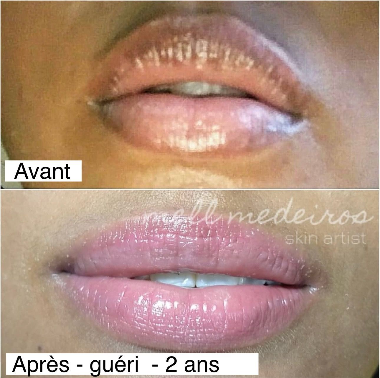 Micropigmentation des Lèvres (Lip Blush) - Melissa Medeiros - Mell Medeiros