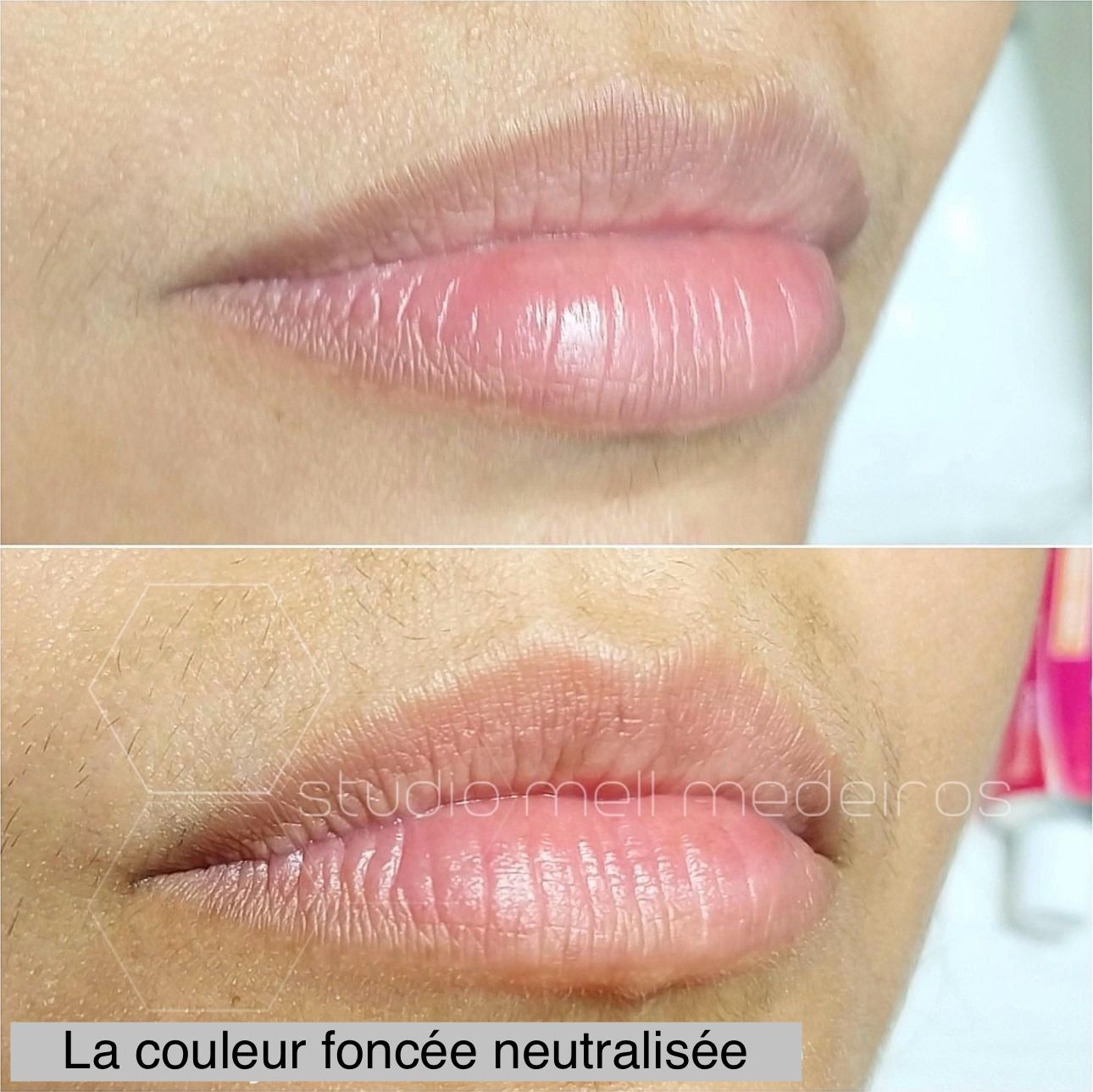 Micropigmentation des Lèvres (Lip Blush) - Melissa Medeiros - Mell Medeiros