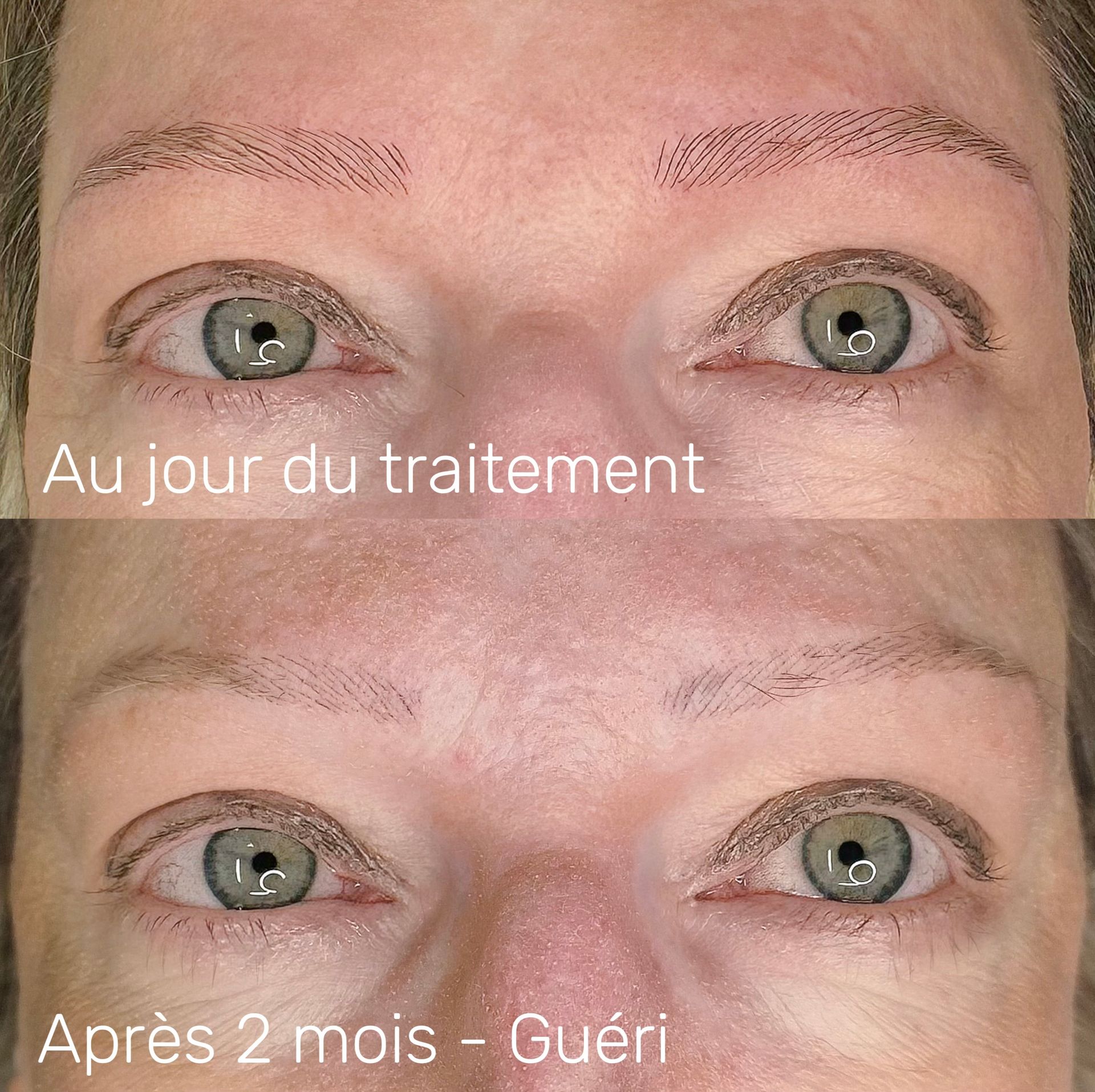 Microblading - Melissa Medeiros - Mell Medeiros