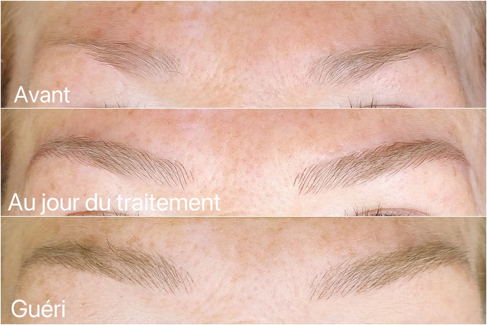 Microblading - Mélissa Medeiros - Mell Medeiros