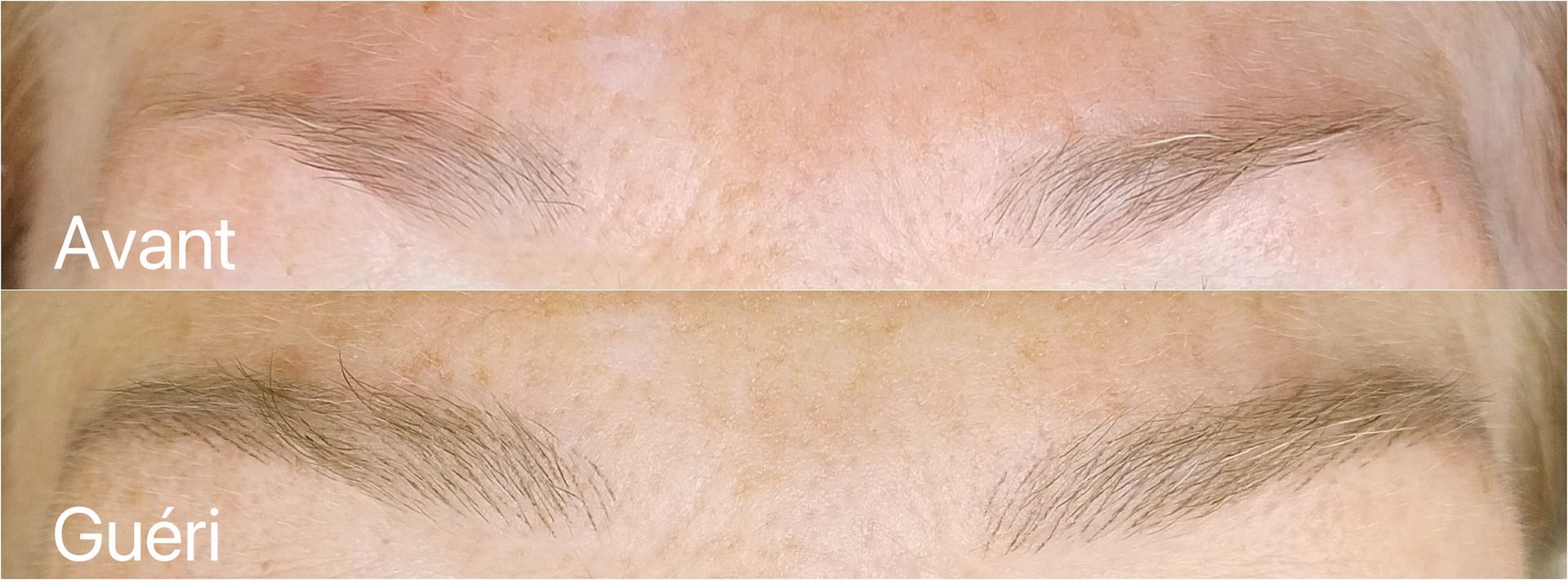 Microblading - Mélissa Medeiros - Mell Medeiros