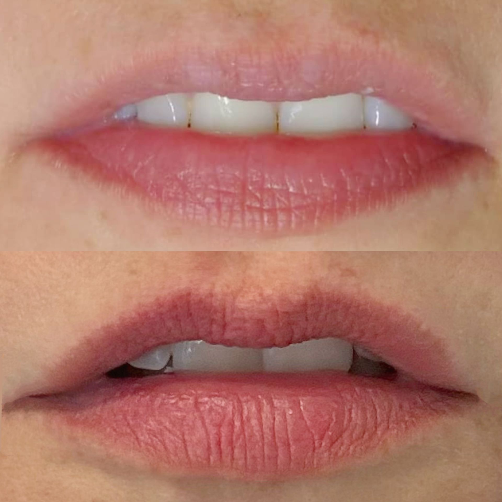 Micropigmentation des Lèvres (Lip Blush) - Melissa Medeiros - Mell Medeiros