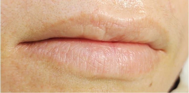 Micropigmentation des Lèvres (Lip Blush) - Melissa Medeiros - Mell Medeiros 