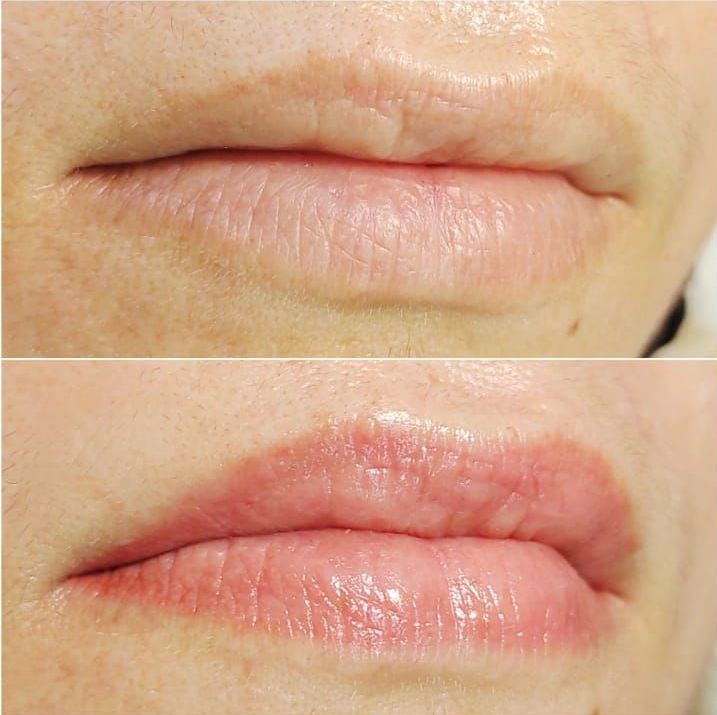 Micropigmentation des Lèvres (Lip Blush) - Melissa Medeiros - Mell Medeiros