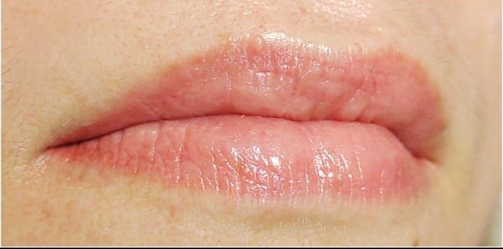 Micropigmentation des Lèvres (Lip Blush) - Melissa Medeiros - Mell Medeiros 