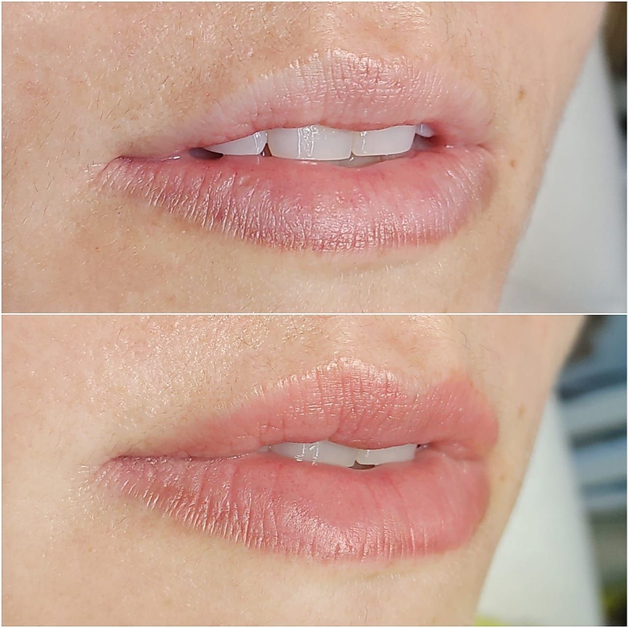 Micropigmentation des Lèvres (Lip Blush) Melissa Medeiros - Mell Medeiros