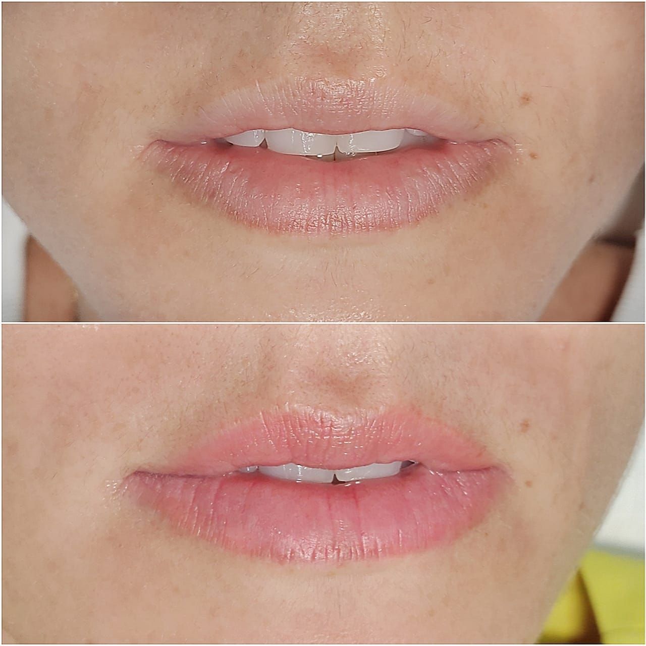 Micropigmentation des Lèvres (Lip Blush) - Melissa Medeiros - Mell Medeiros