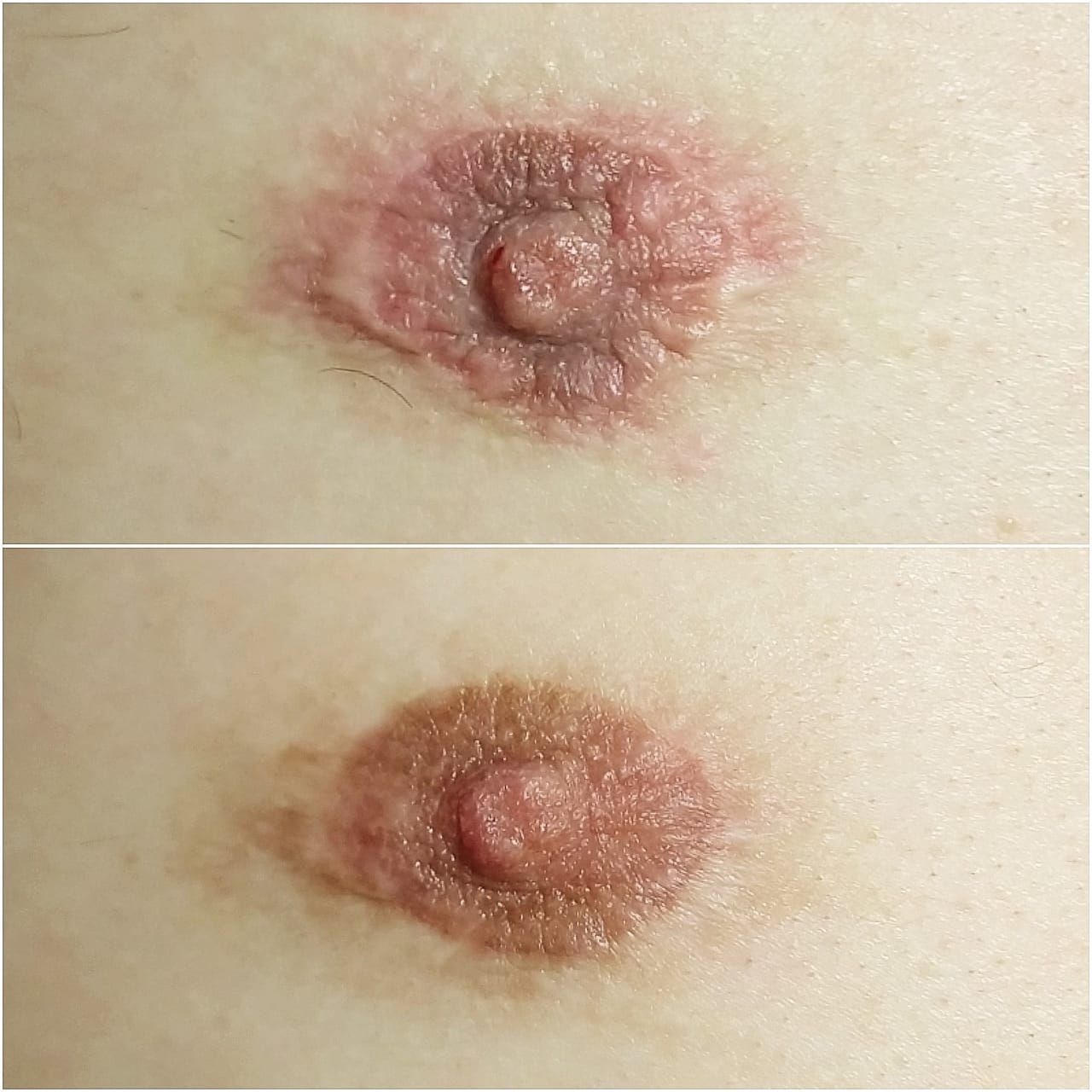 Tatouage Médical pour Hommes - Melissa Medeiros - Mell Medeiros 