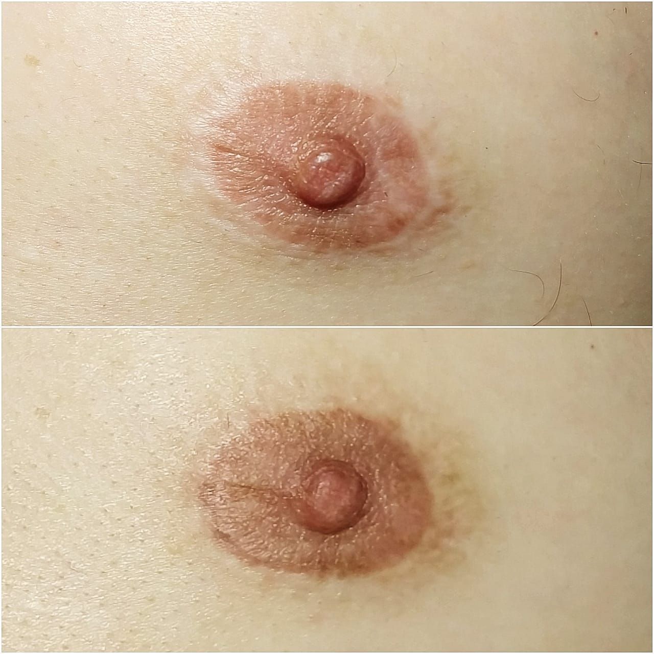 Tatouage Médical pour Hommes - Melissa Medeiros - Mell Medeiros 