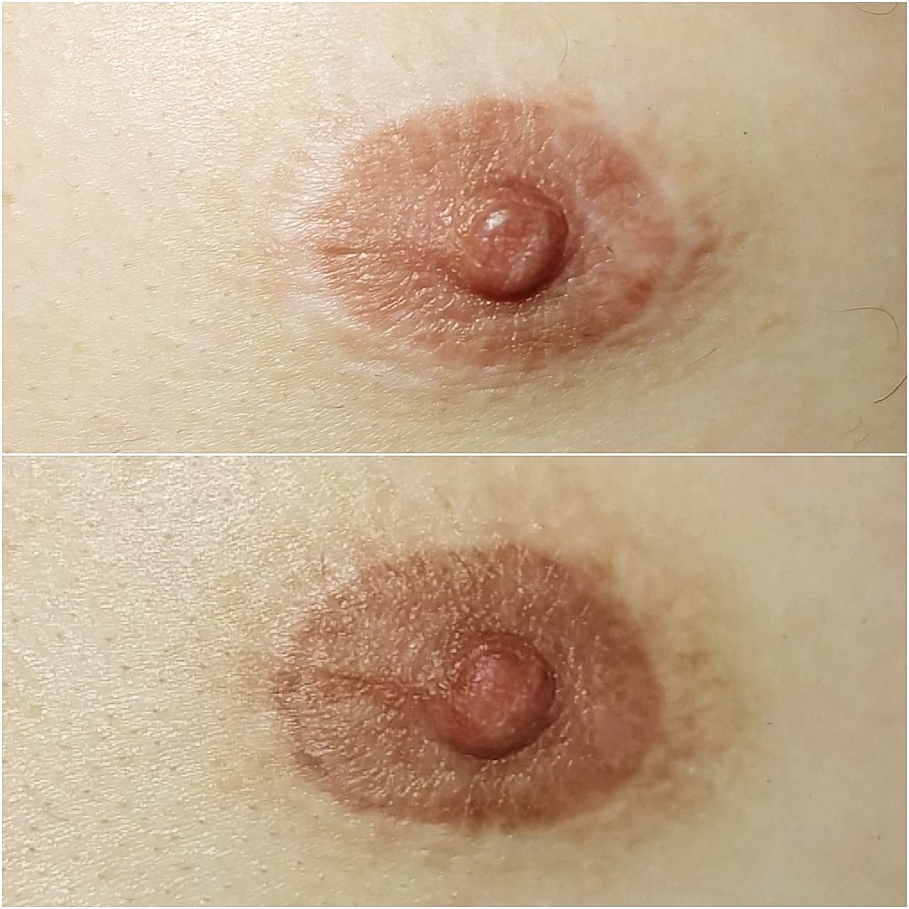 Tatouage Médical pour Hommes - Melissa Medeiros - Mell Medeiros 