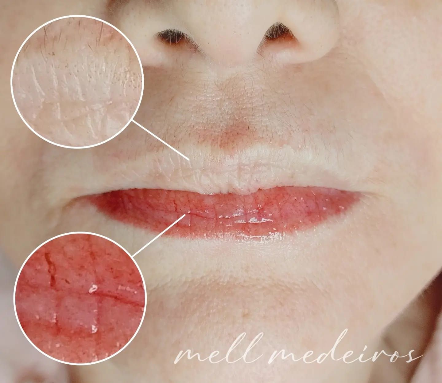 Micropigmentation des Lèvres (Lip Blush) - Melissa Medeiros - Mell Medeiros