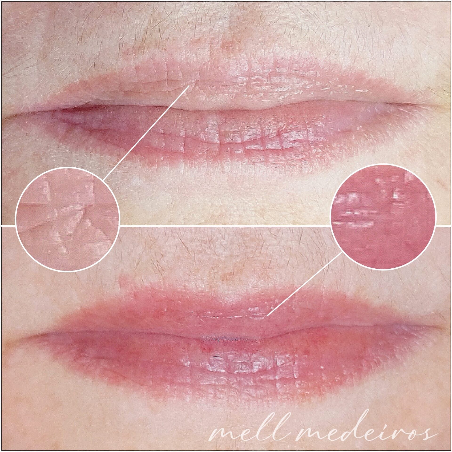 Micropigmentation des Lèvres (Lip Blush) - Melissa Medeiros - Mell Medeiros