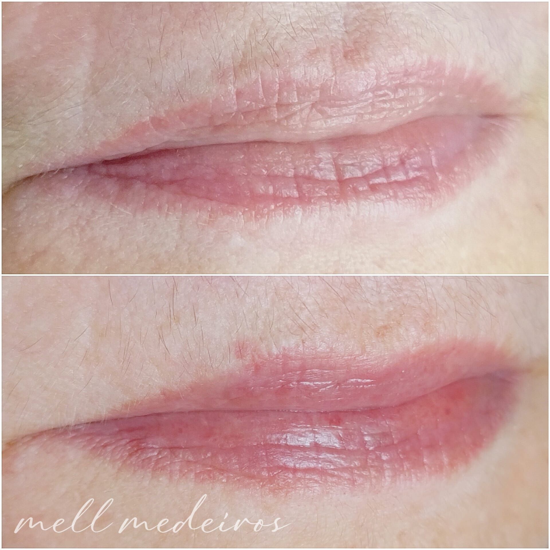 Micropigmentation des Lèvres (Lip Blush) Melissa Medeiros - Mell Medeiros