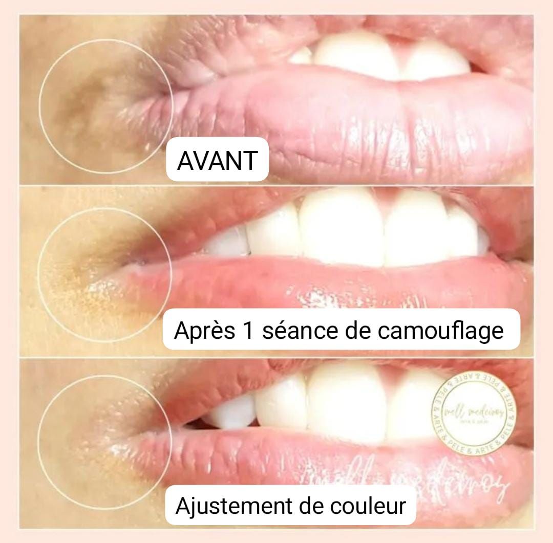 Camouflage de la peau - Melissa Medeiros - Mell Medeiros