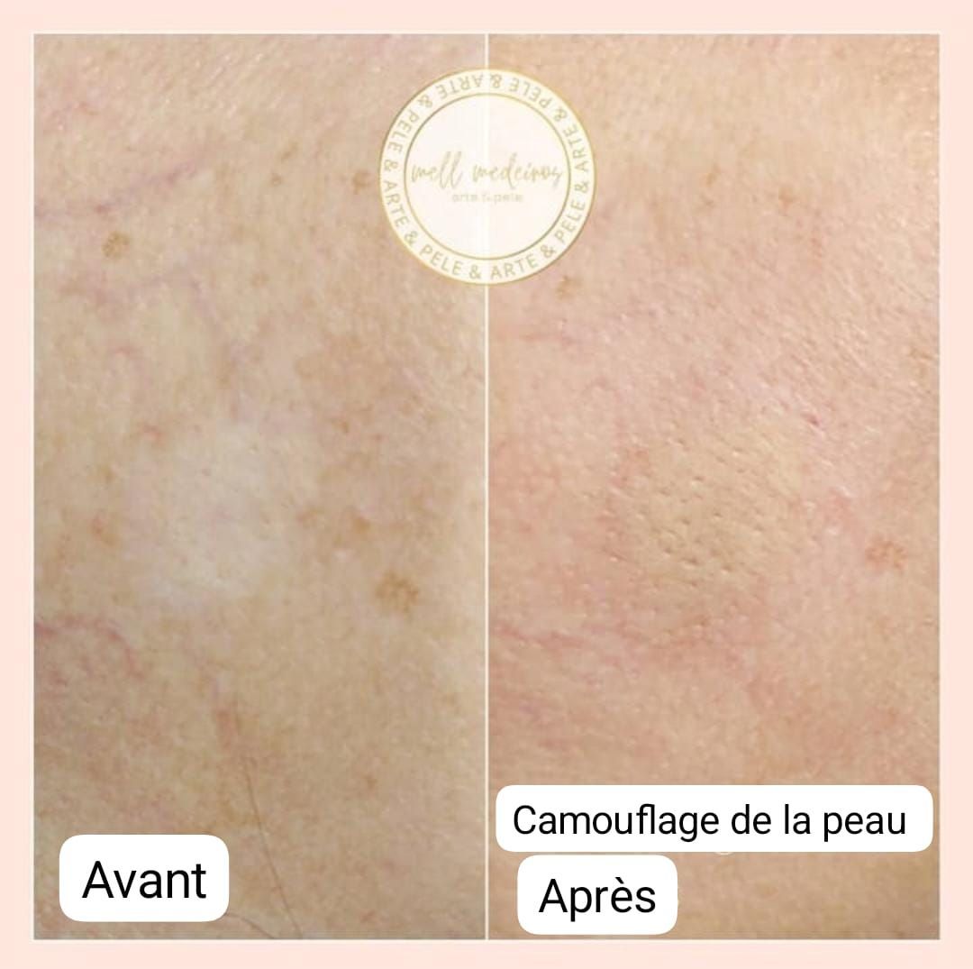 Camouflage de la peau - Melissa Medeiros - Mell Medeiros