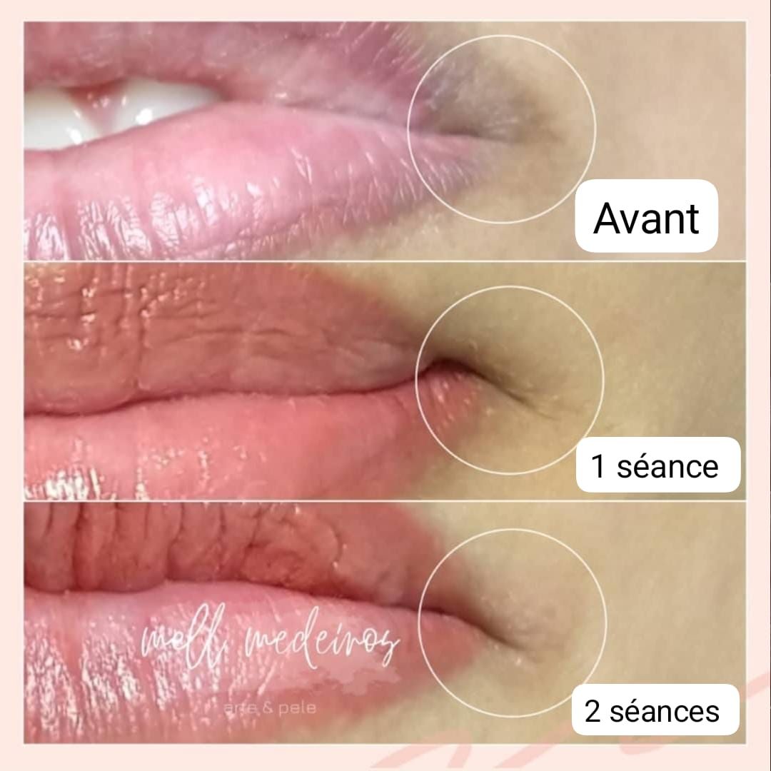 Camouflage de la peau - Melissa Medeiros - Mell Medeiros