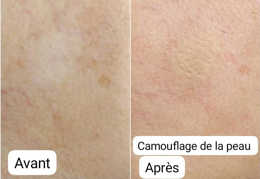 Tatouage Médical pour Hommes - Melissa Medeiros - Mell Medeiros 