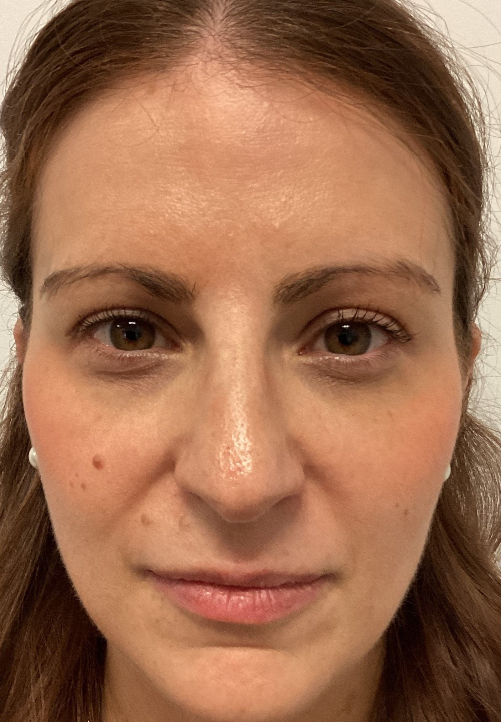 Agents de comblement