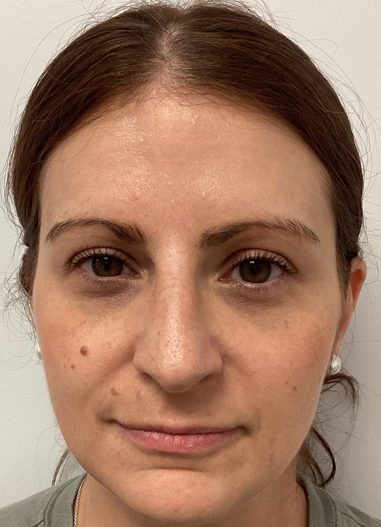 Agents de comblement