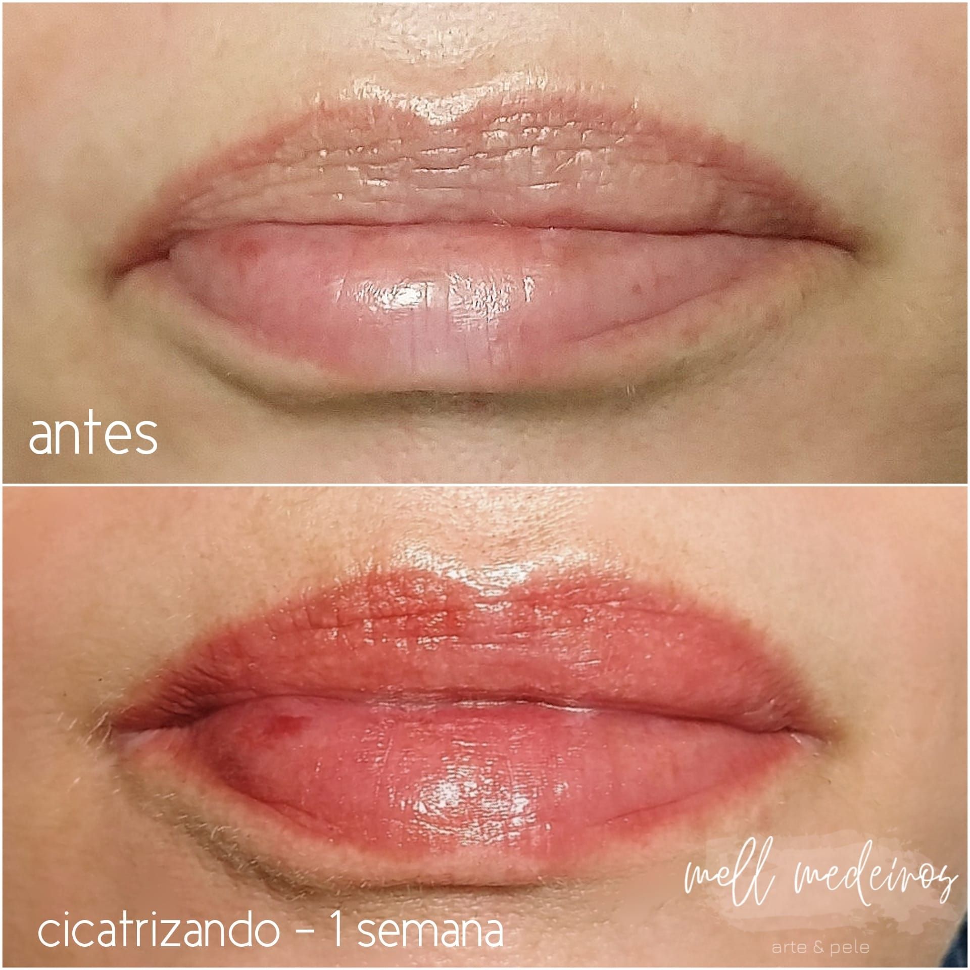 Micropigmentation des Lèvres (Lip Blush) - Melissa Medeiros - Mell Medeiros