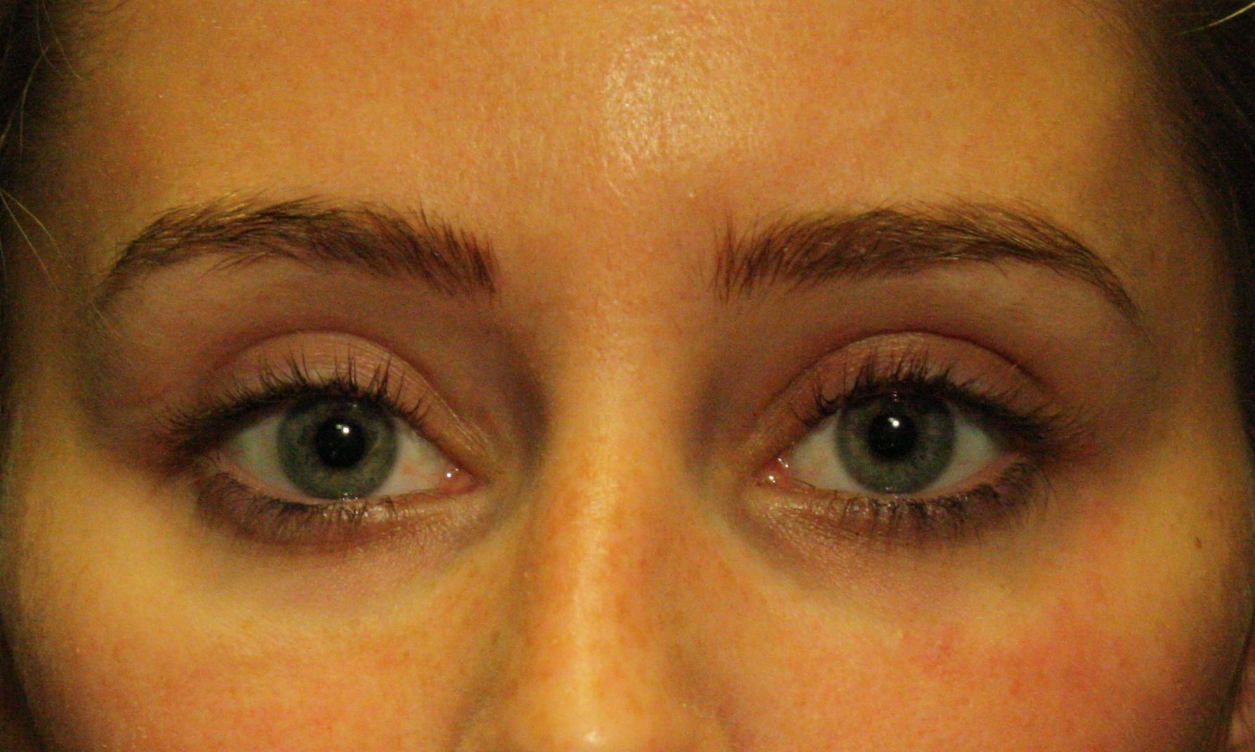 agent de comblement, yeux