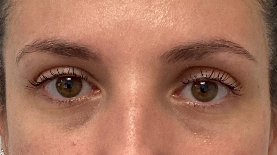 Agents de comblement