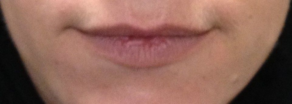 Lèvres