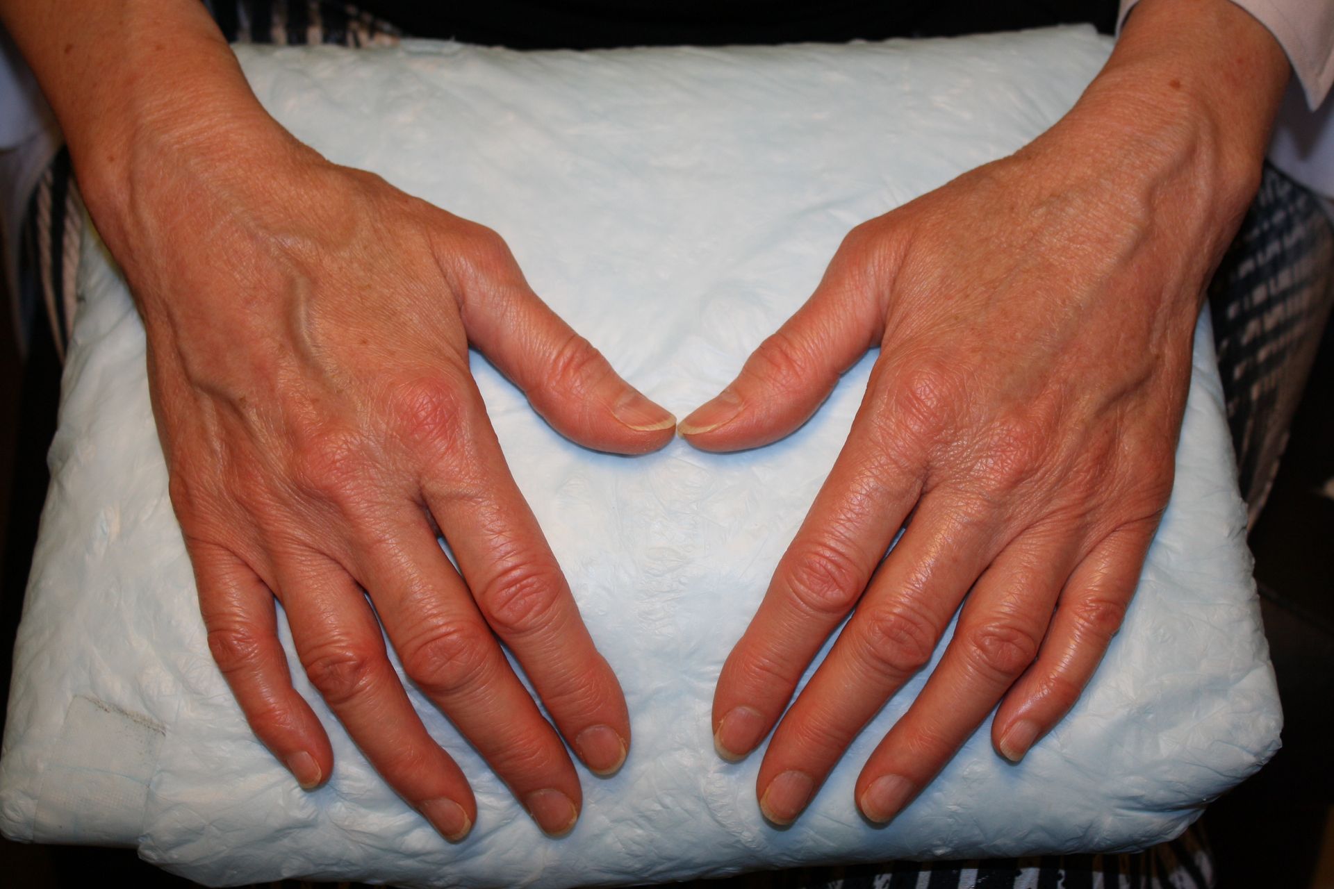 agent de comblement, mains