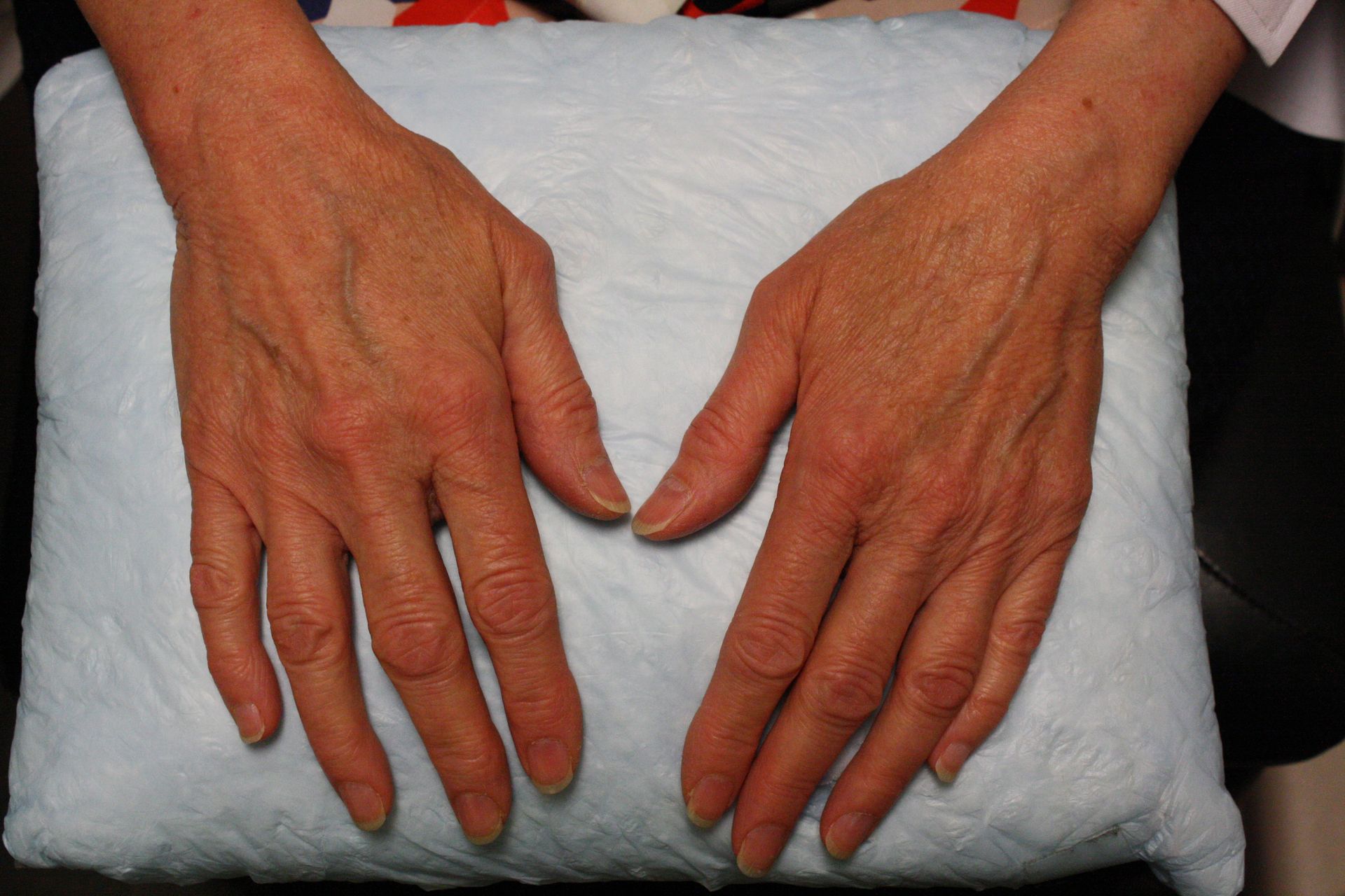 agent de comblement, mains