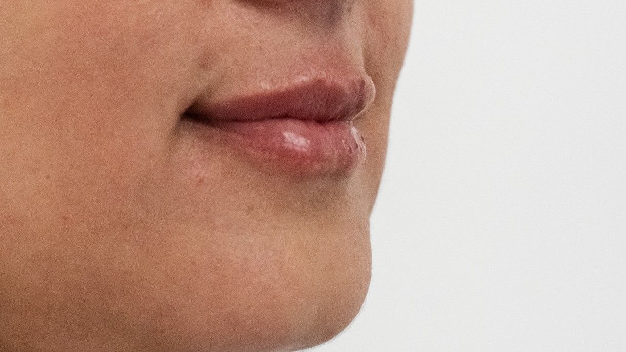 Agents de comblement