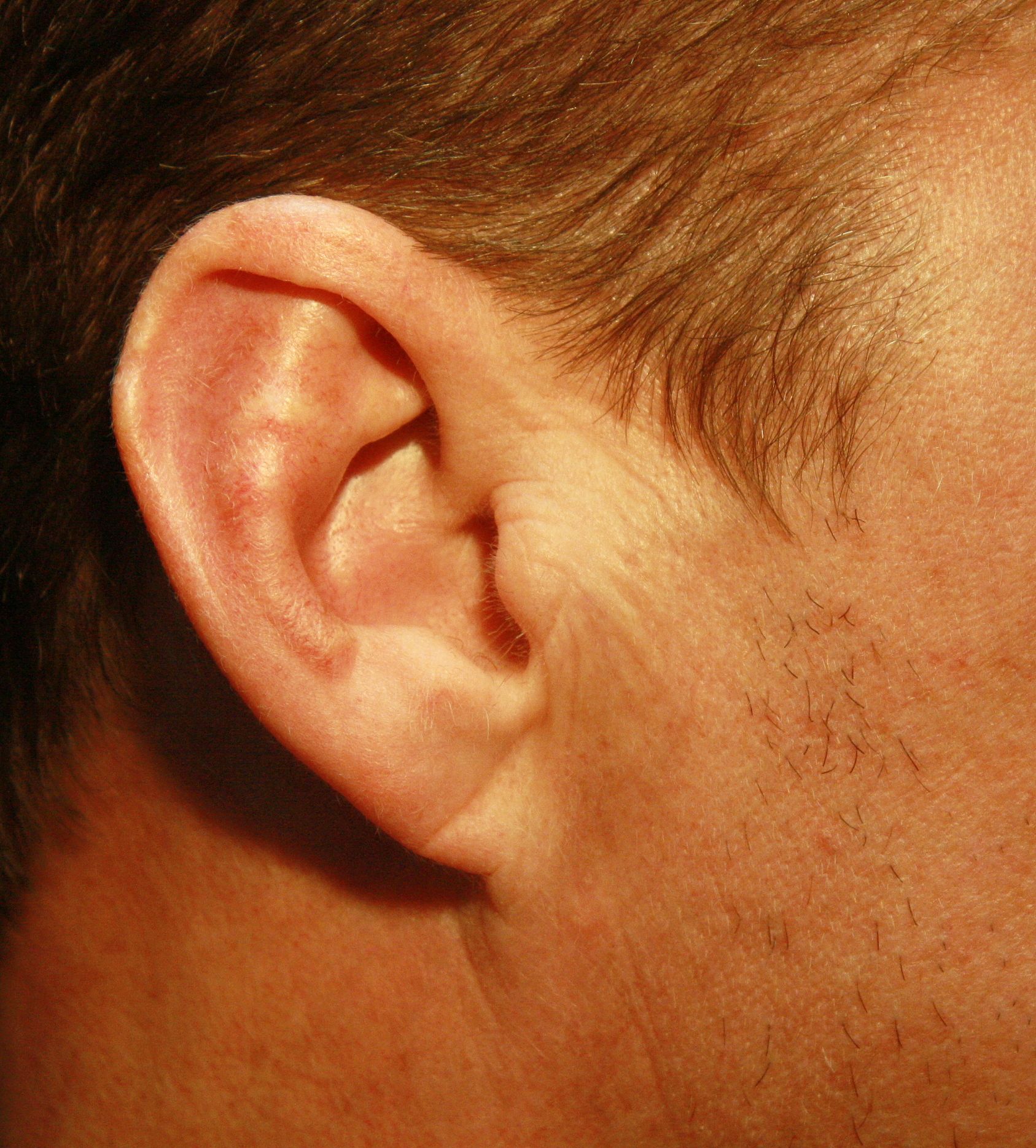 Agents de comblement