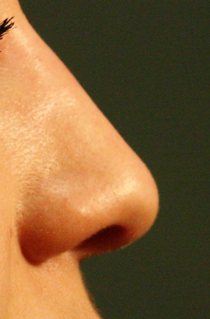 Agents de comblement