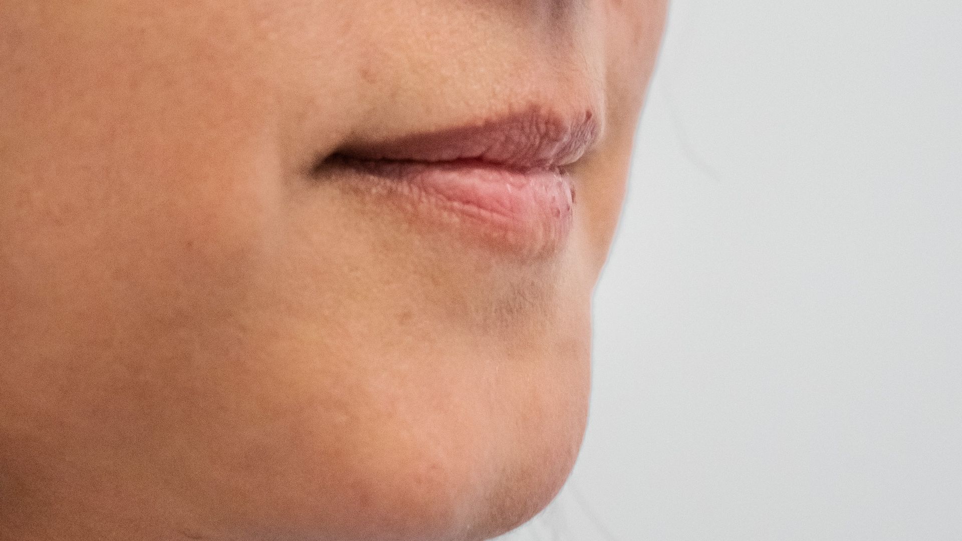 Agents de comblement