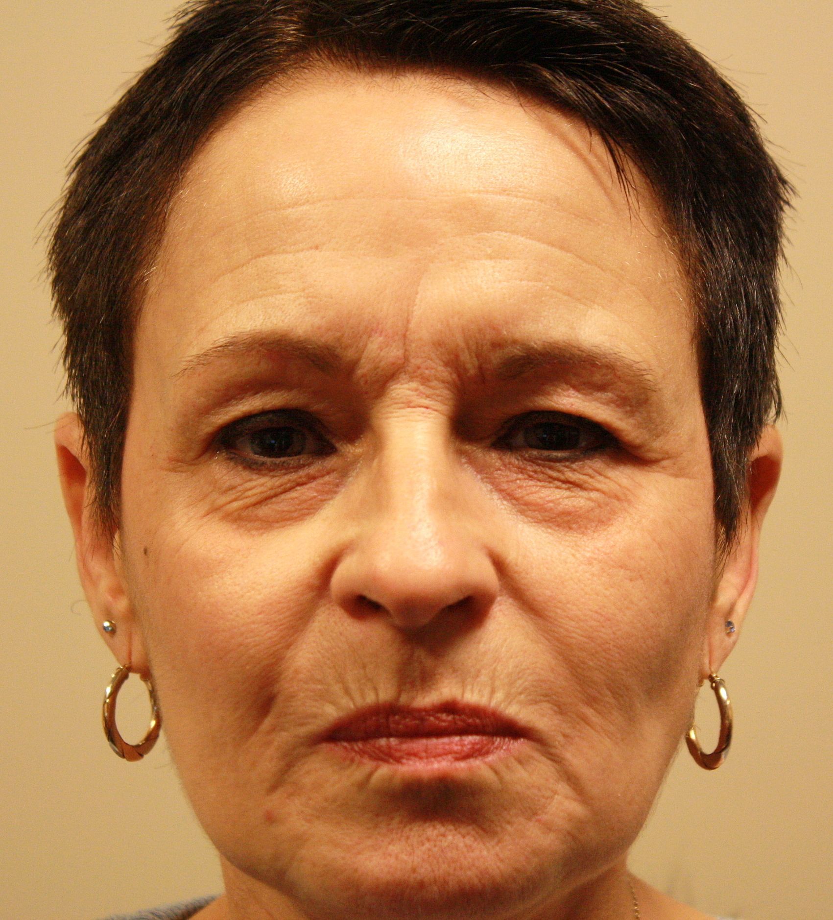 Agents de comblement