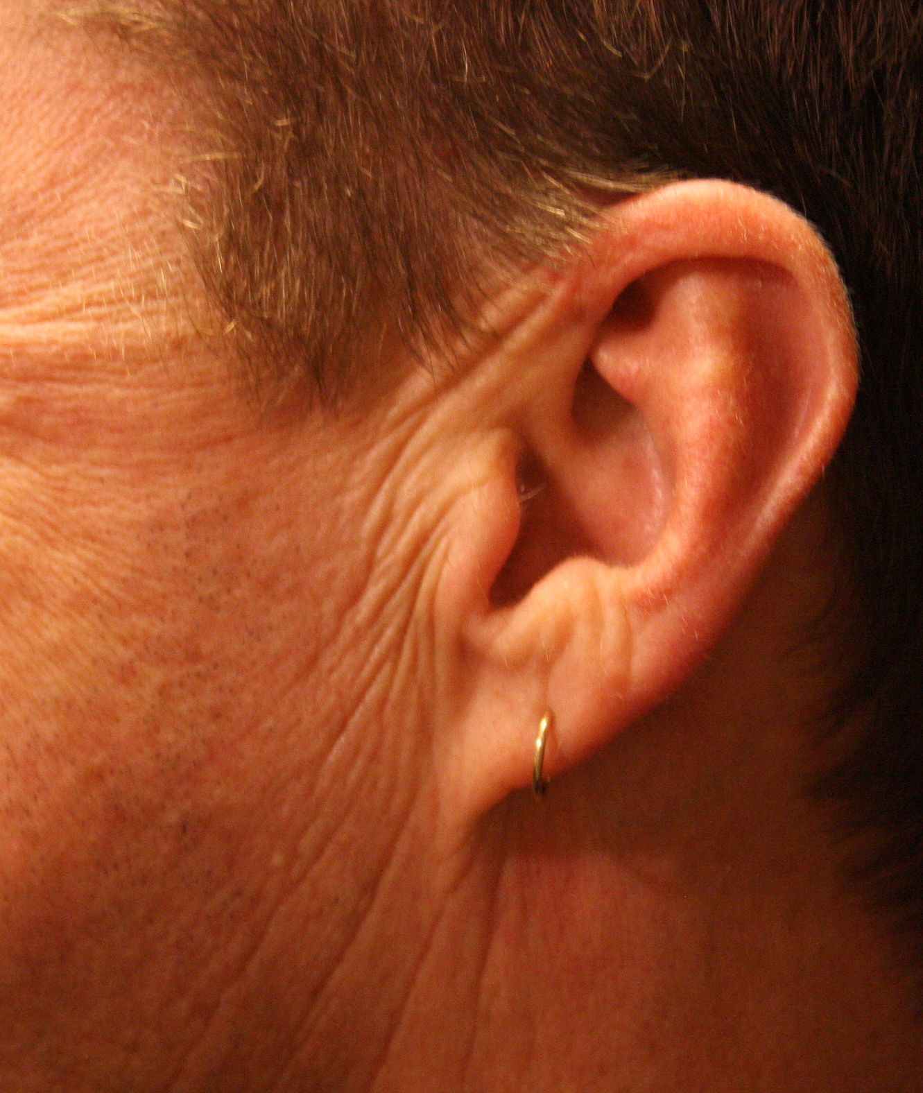 Agents de comblement