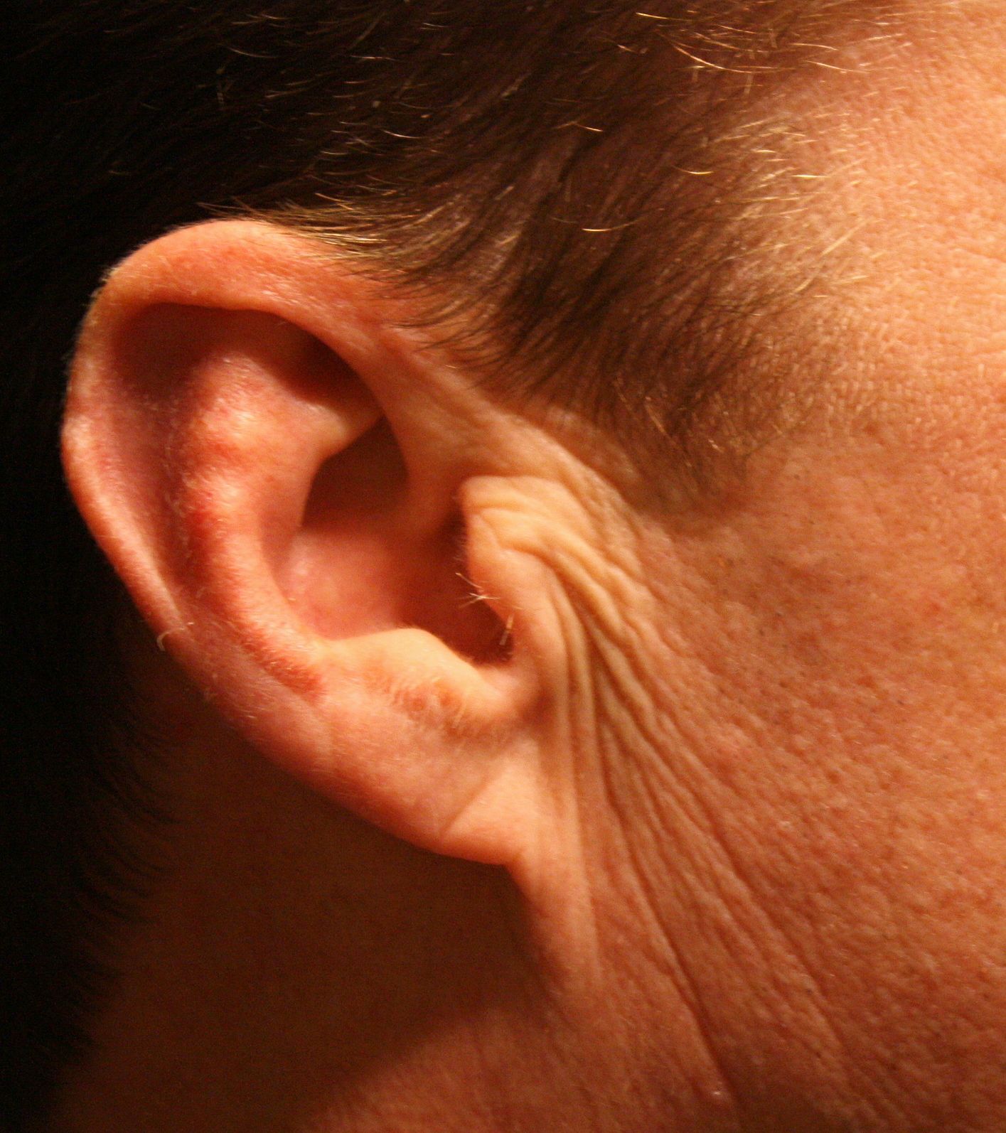 Agents de comblement