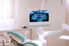 General Dentistry — Digital Xrays  in Mukilteo, WA
