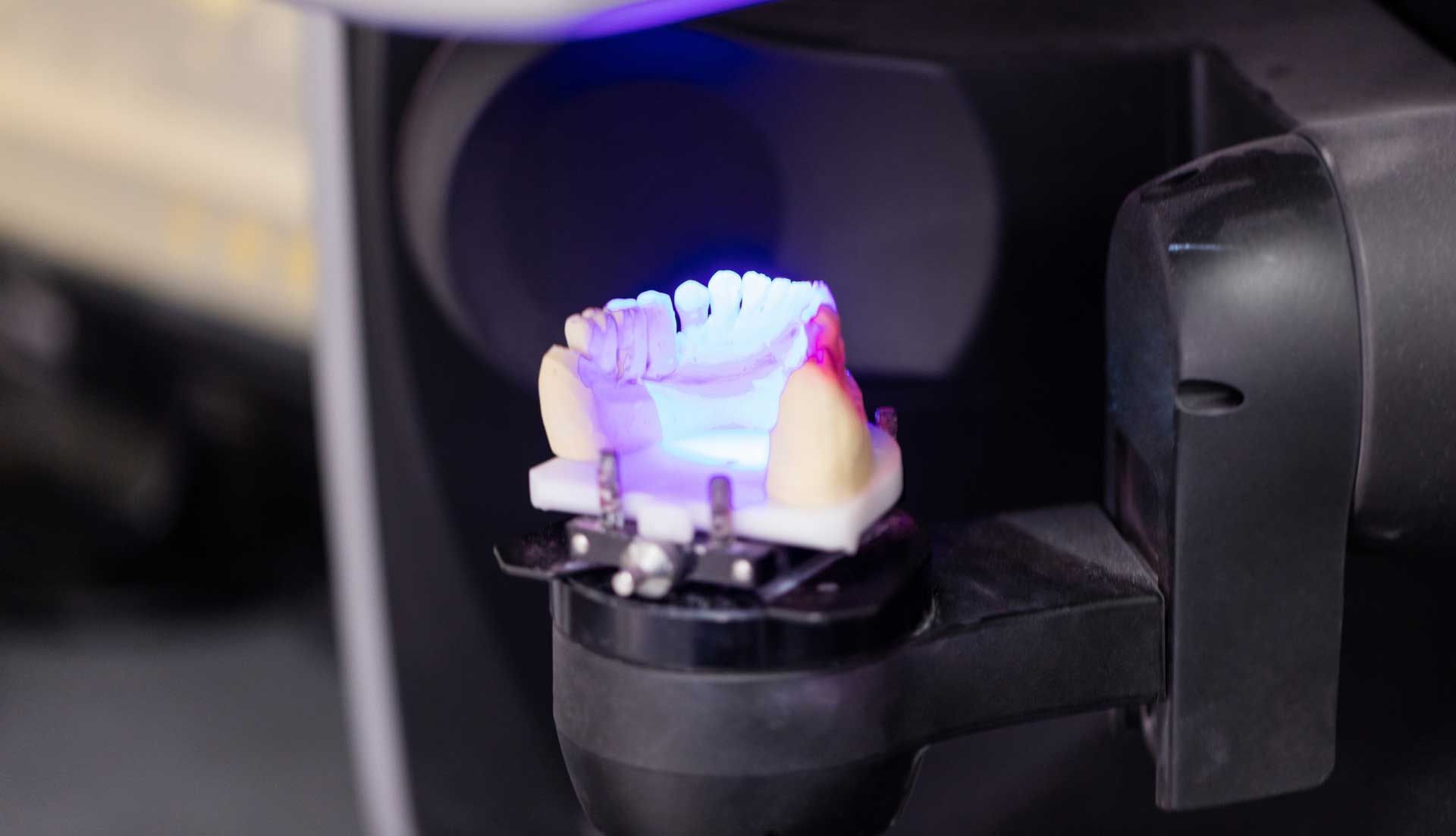 Dental mold being scanned by a machine, illuminated with blue light.