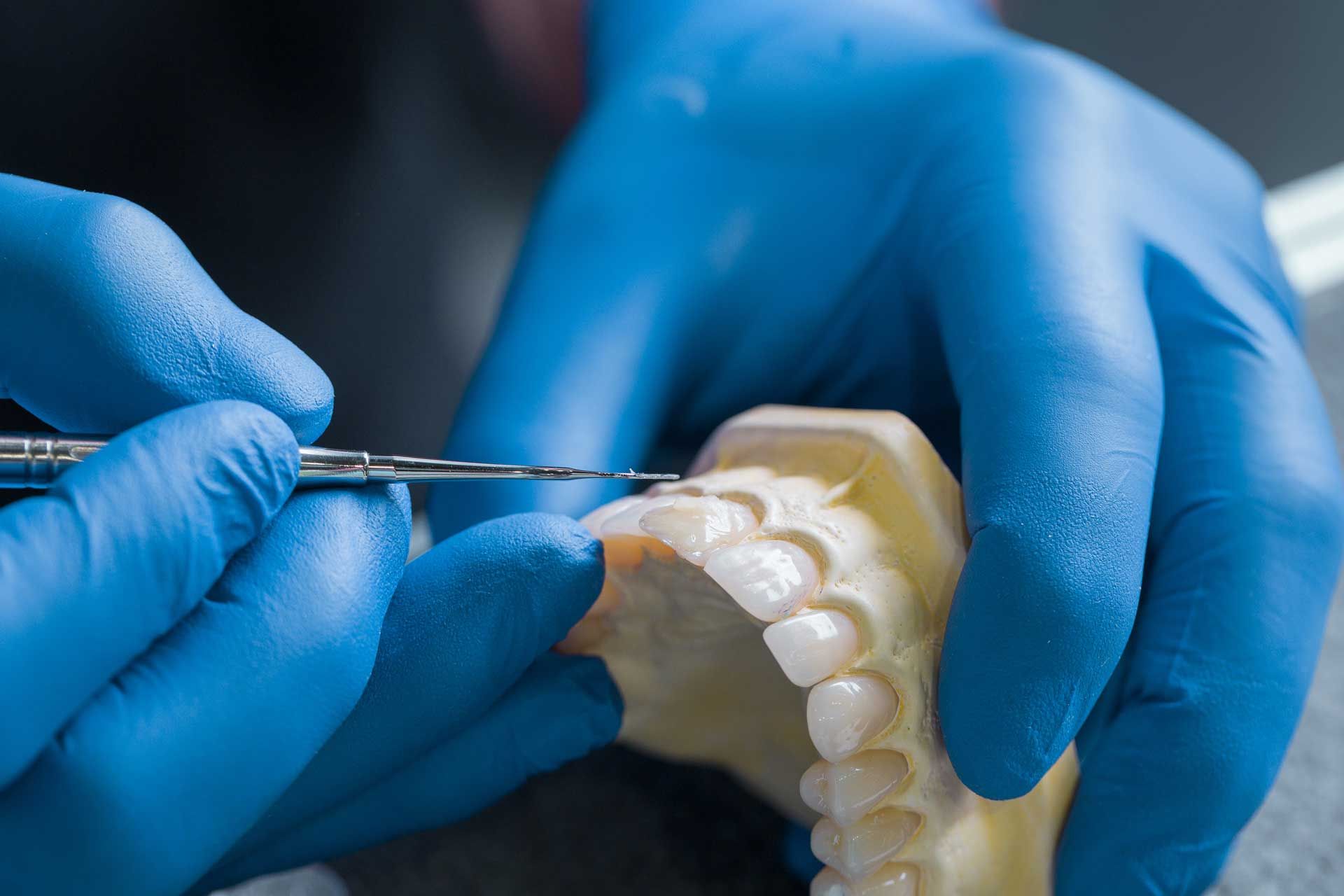 Hands in blue gloves using a tool on a teeth model.