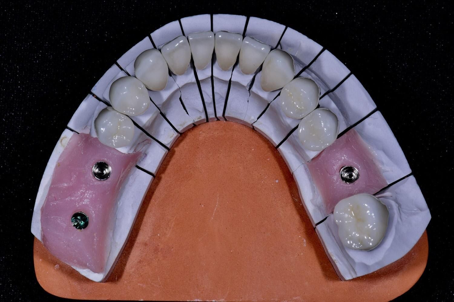 DENTAL PLUS SLP