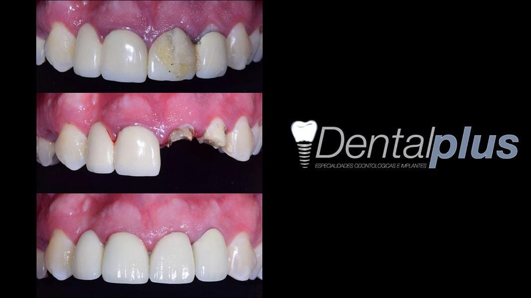 DENTAL PLUS SLP