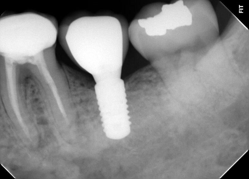 DENTAL PLUS SLP