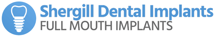 Shergill Dental Implants Birmingham
